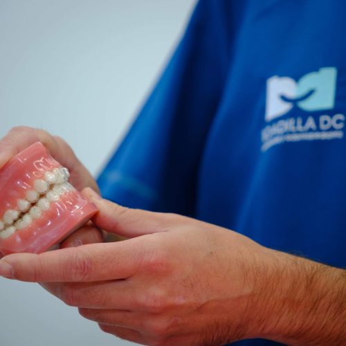 Prótesis dental en Brunete